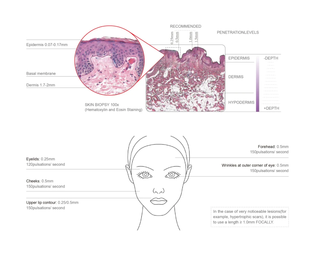 Microneedling Rechargeable Home Use Meso Pen Medical Use Derma Pen